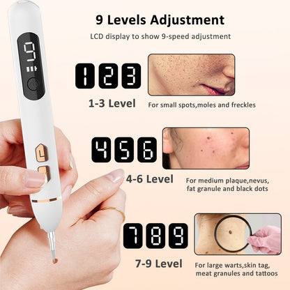 Laser Plasma Pen - Moles, Warts, Dark Spots Remover